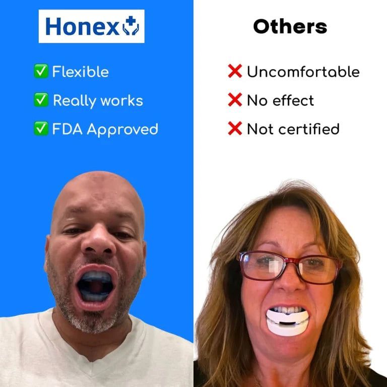 The Quiet Anti-Snoring Mouthpiece (Universal Size)